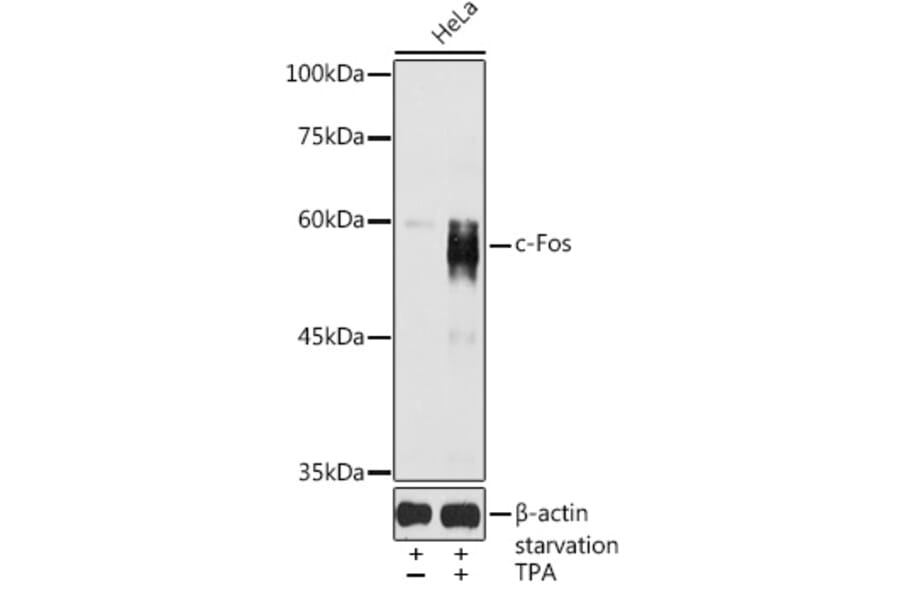 Western Blot - Anti-c-Fos Antibody (A91695) - Antibodies.com