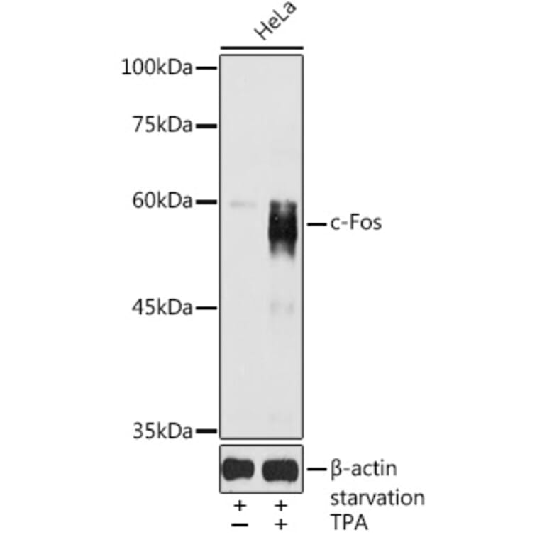 Western Blot - Anti-c-Fos Antibody (A91695) - Antibodies.com
