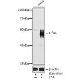 Western Blot - Anti-c-Fos Antibody (A91695) - Antibodies.com