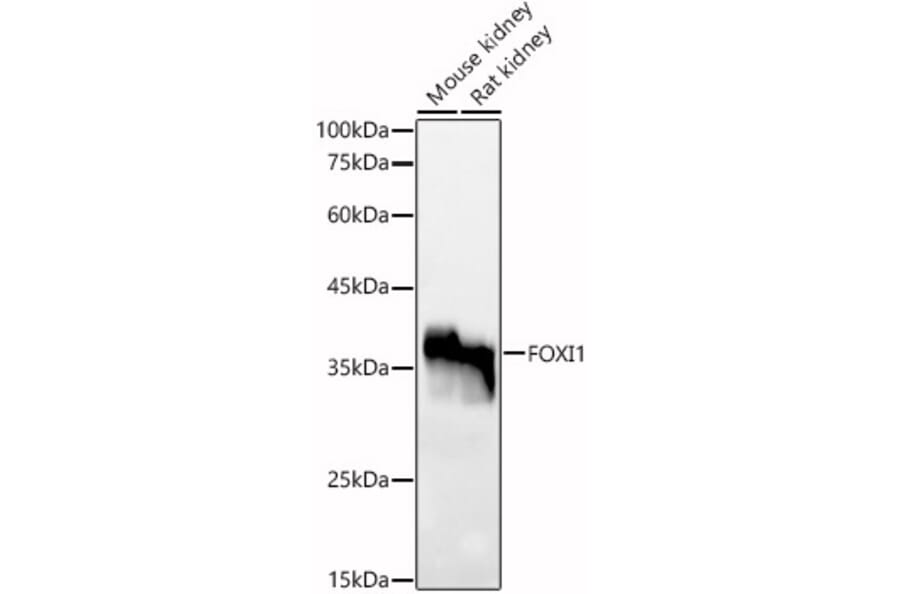 Western Blot - Anti-FOXI1 Antibody (A91696) - Antibodies.com