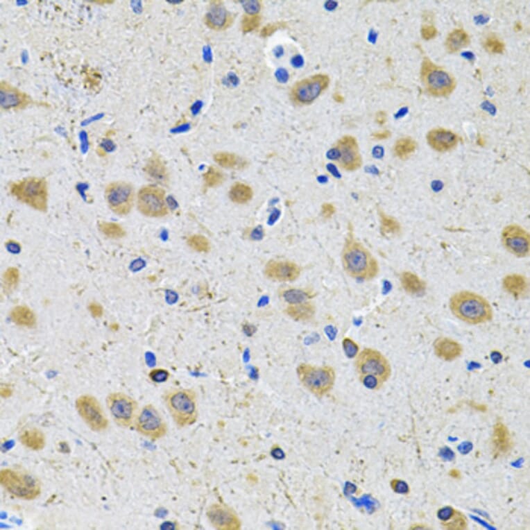 Immunohistochemistry - Anti-GRIN1 Antibody (A13995) - Antibodies.com