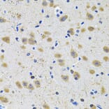Immunohistochemistry - Anti-GRIN1 Antibody (A13995) - Antibodies.com