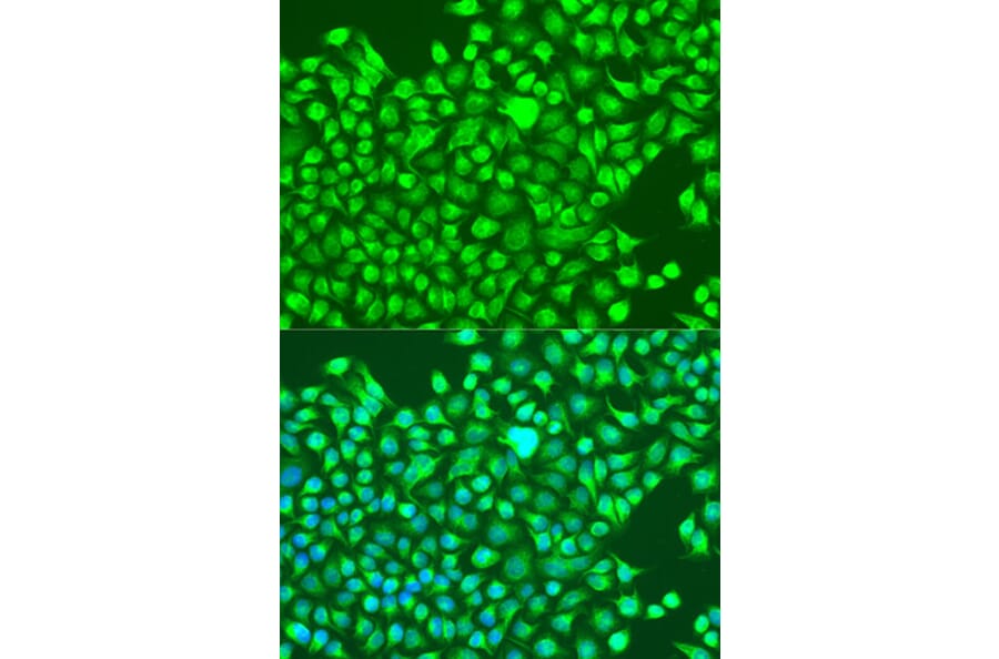 Immunofluorescence - Anti-GRIN1 Antibody (A13995) - Antibodies.com