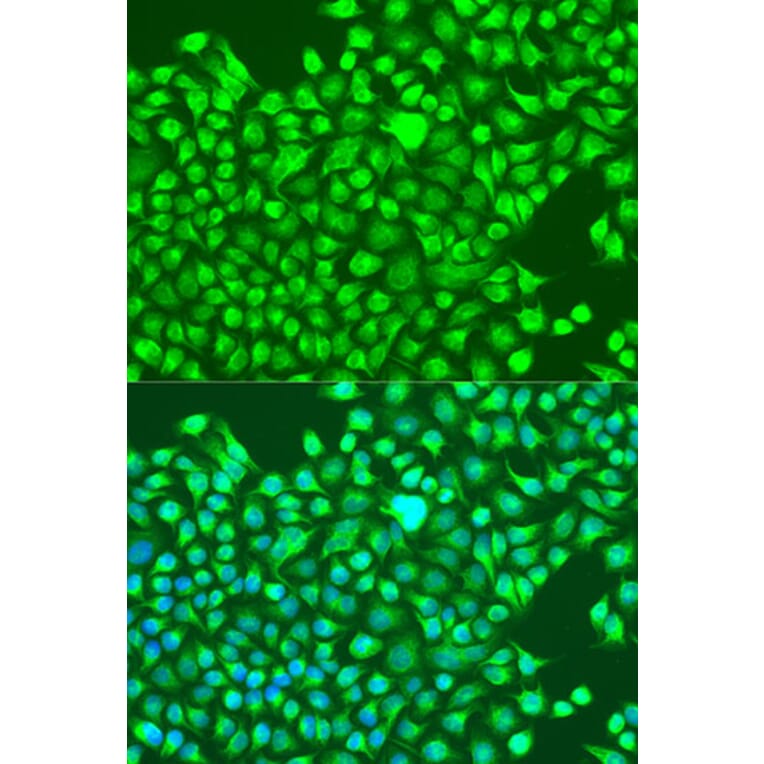 Immunofluorescence - Anti-GRIN1 Antibody (A13995) - Antibodies.com
