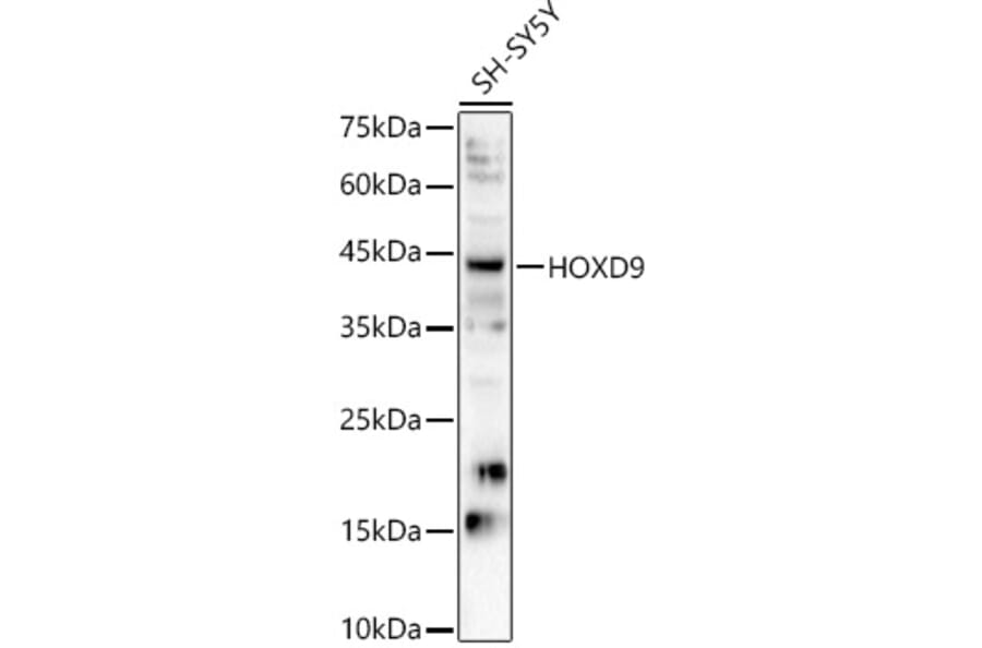 Western Blot - Anti-HOXD9 Antibody (A91699) - Antibodies.com