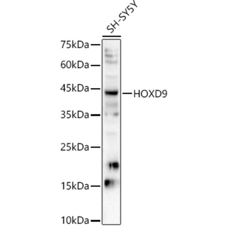 Western Blot - Anti-HOXD9 Antibody (A91699) - Antibodies.com