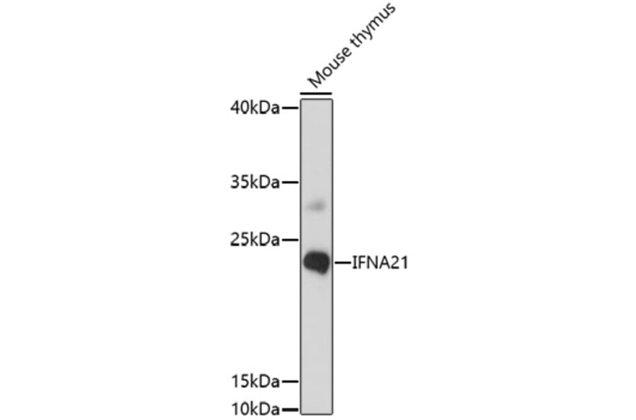 Western Blot - Anti-IFNA21 Antibody (A91700) - Antibodies.com