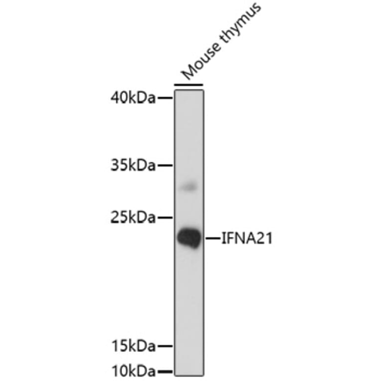 Western Blot - Anti-IFNA21 Antibody (A91700) - Antibodies.com