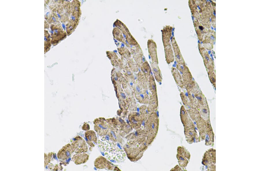 Immunohistochemistry - Anti-IKBKG Antibody (A12561) - Antibodies.com