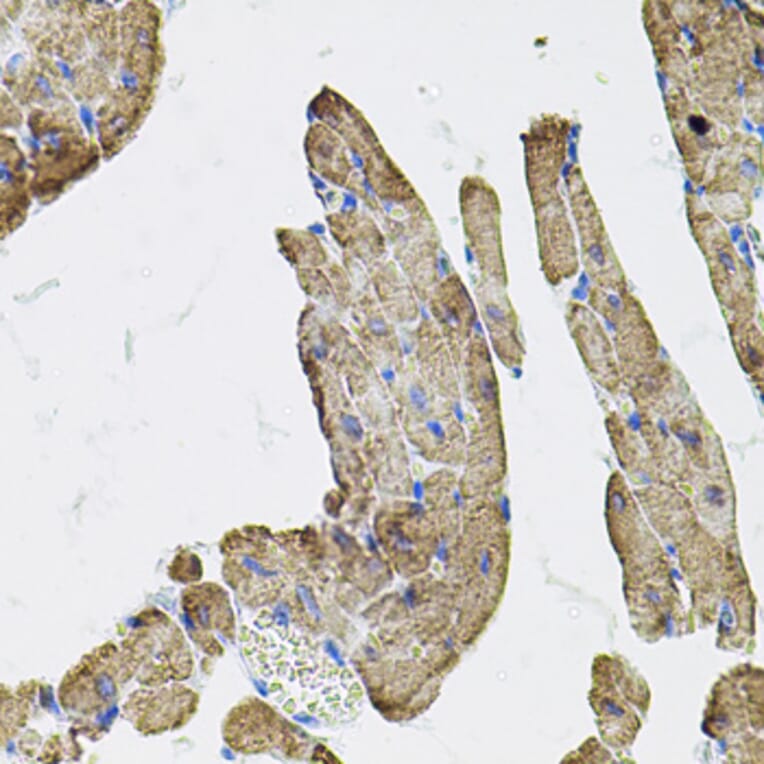 Immunohistochemistry - Anti-IKBKG Antibody (A12561) - Antibodies.com