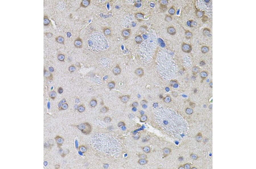 Immunohistochemistry - Anti-IKBKG Antibody (A12561) - Antibodies.com