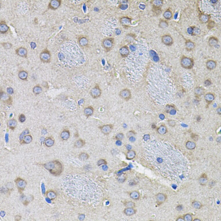 Immunohistochemistry - Anti-IKBKG Antibody (A12561) - Antibodies.com