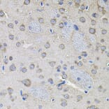 Immunohistochemistry - Anti-IKBKG Antibody (A12561) - Antibodies.com