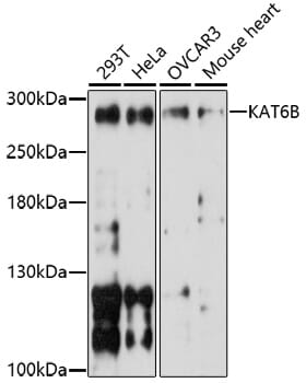 Western blot analysis of extracts of various cell lines, using Anti-KAT6B Antibody (A17116) at 1:1,000 dilution.
Secondary antibody: Goat Anti-Rabbit IgG (H+L) (HRP) (AS014) at 1:10,000 dilution.
Lysates / proteins: 25µg per lane.
Blocking buffer: 3% non-fat dry milk in TBST.
Detection: ECL Basic Kit (RM00020).
Exposure time: 90s.