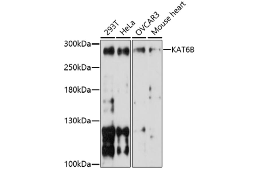 Western Blot - Anti-KAT6B/MORF Antibody (A91703) - Antibodies.com