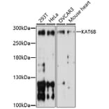 Western Blot - Anti-KAT6B/MORF Antibody (A91703) - Antibodies.com