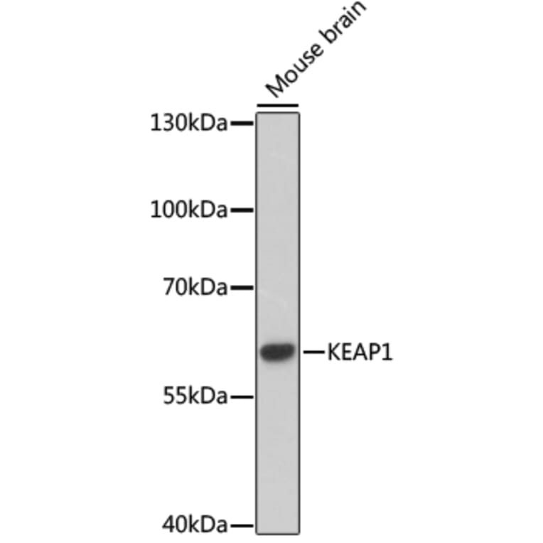 Western Blot - Anti-KEAP1 Antibody (A17061) - Antibodies.com