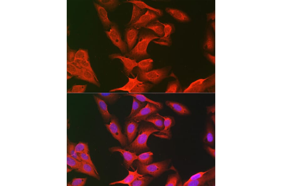 Immunofluorescence - Anti-Keap1 Antibody (A91705) - Antibodies.com