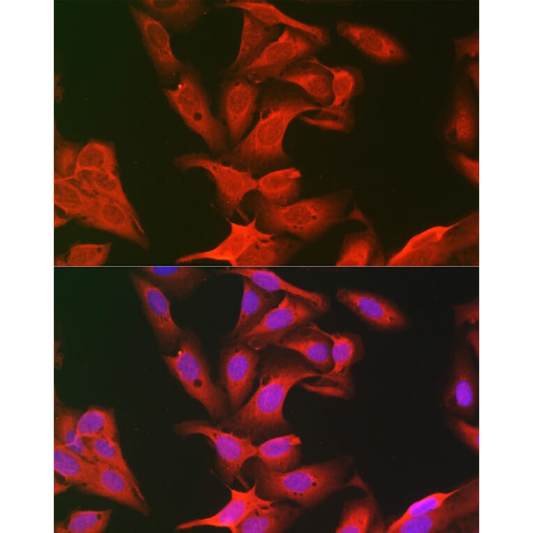 Immunofluorescence - Anti-Keap1 Antibody (A91705) - Antibodies.com