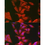 Immunofluorescence - Anti-Keap1 Antibody (A91705) - Antibodies.com