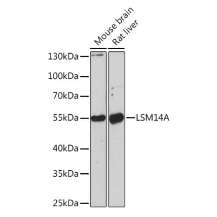 Western Blot - Anti-RAP55 Antibody (A91708) - Antibodies.com