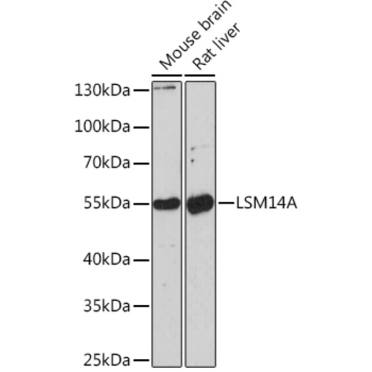 Western Blot - Anti-RAP55 Antibody (A91708) - Antibodies.com