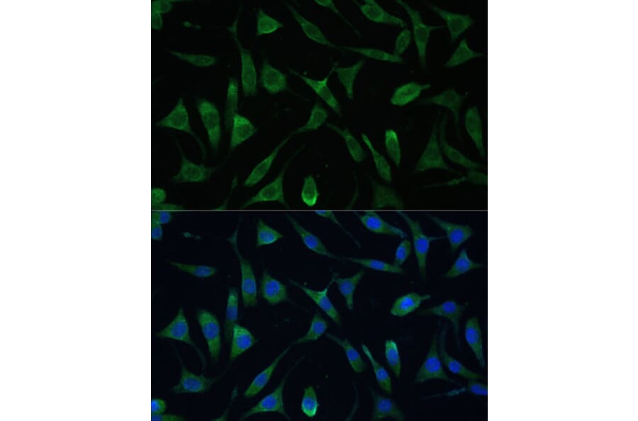 Immunofluorescence - Anti-RAP55 Antibody (A91708) - Antibodies.com