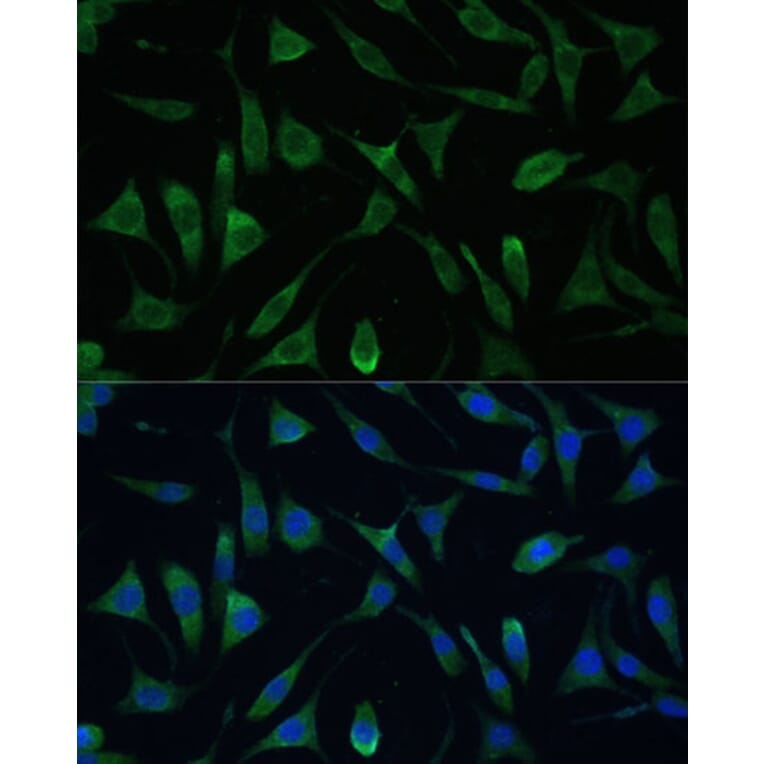 Immunofluorescence - Anti-RAP55 Antibody (A91708) - Antibodies.com