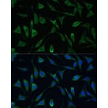 Immunofluorescence - Anti-RAP55 Antibody (A91708) - Antibodies.com