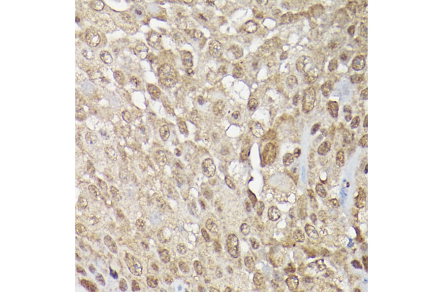 Immunohistochemistry - Anti-ERK1 + ERK2 Antibody (A91710) - Antibodies.com