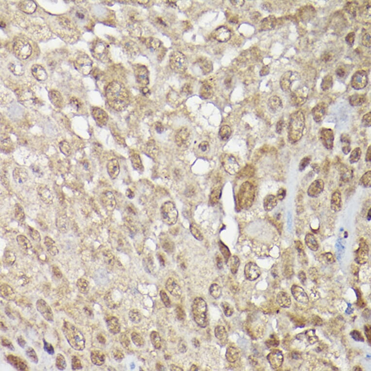 Immunohistochemistry - Anti-ERK1 + ERK2 Antibody (A91710) - Antibodies.com