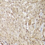 Immunohistochemistry - Anti-ERK1 + ERK2 Antibody (A91710) - Antibodies.com