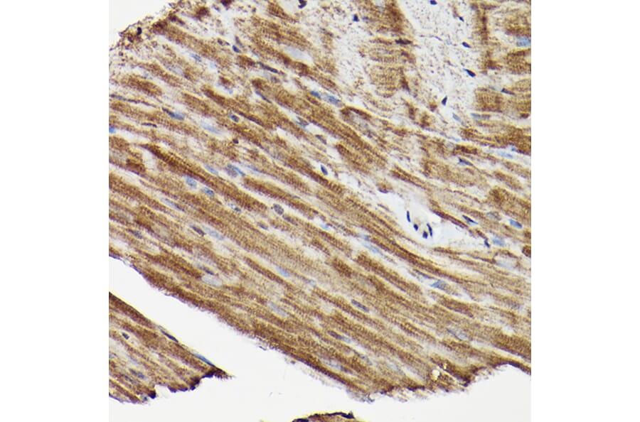 Immunohistochemistry - Anti-ERK1 + ERK2 Antibody (A91710) - Antibodies.com
