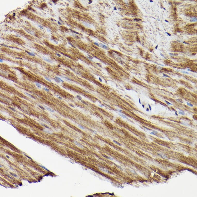 Immunohistochemistry - Anti-ERK1 + ERK2 Antibody (A91710) - Antibodies.com