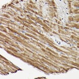 Immunohistochemistry - Anti-ERK1 + ERK2 Antibody (A91710) - Antibodies.com