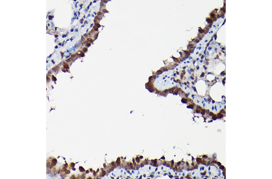 Immunohistochemistry - Anti-ERK1 + ERK2 Antibody (A91710) - Antibodies.com