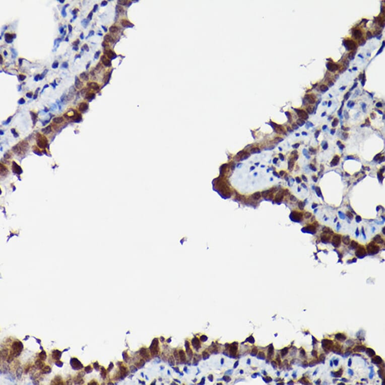 Immunohistochemistry - Anti-ERK1 + ERK2 Antibody (A91710) - Antibodies.com