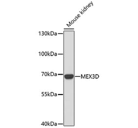 Western Blot - Anti-MEX3D Antibody (A91713) - Antibodies.com