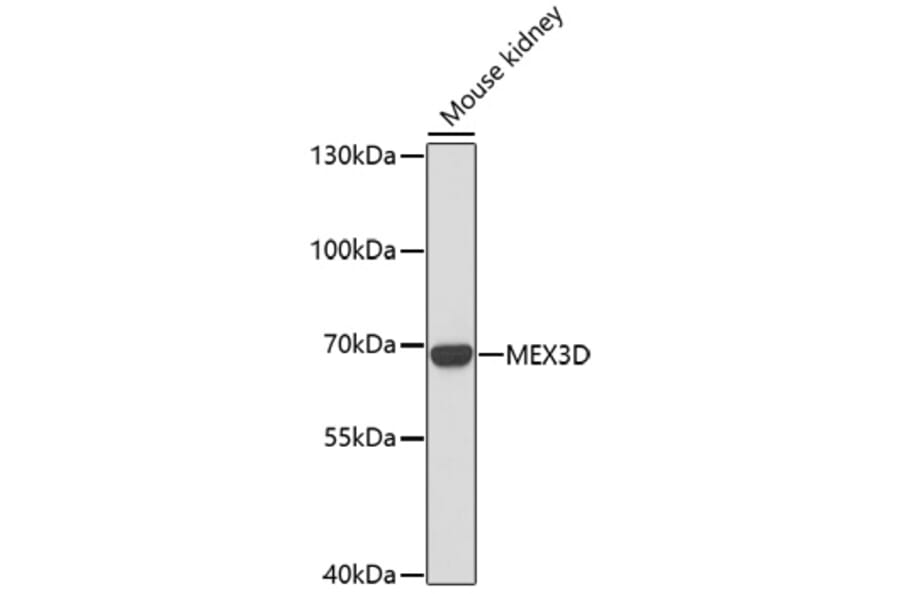Western Blot - Anti-MEX3D Antibody (A91713) - Antibodies.com