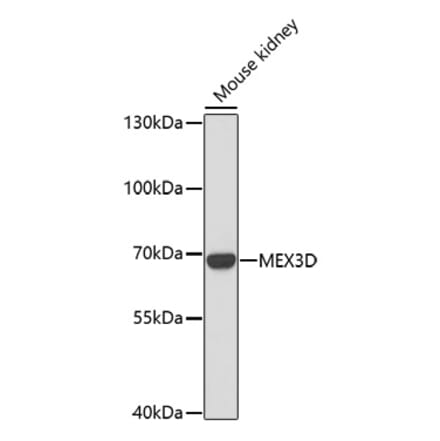 Western Blot - Anti-MEX3D Antibody (A91713) - Antibodies.com
