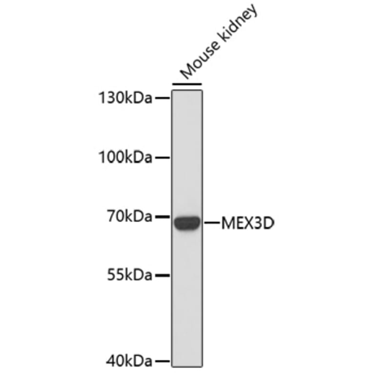 Western Blot - Anti-MEX3D Antibody (A91713) - Antibodies.com