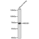 Western Blot - Anti-MEX3D Antibody (A91713) - Antibodies.com