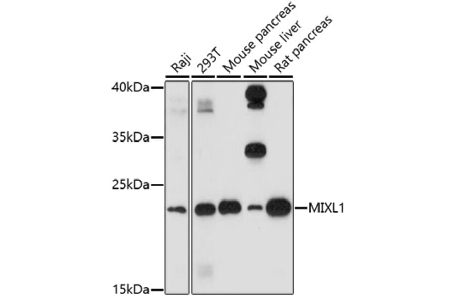 Western Blot - Anti-MIXL1 Antibody (A91714) - Antibodies.com