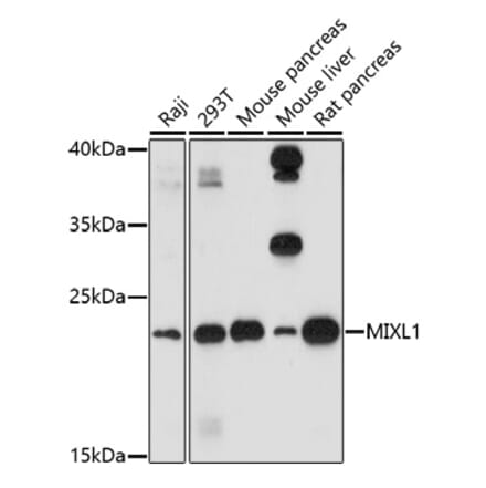 Western Blot - Anti-MIXL1 Antibody (A91714) - Antibodies.com