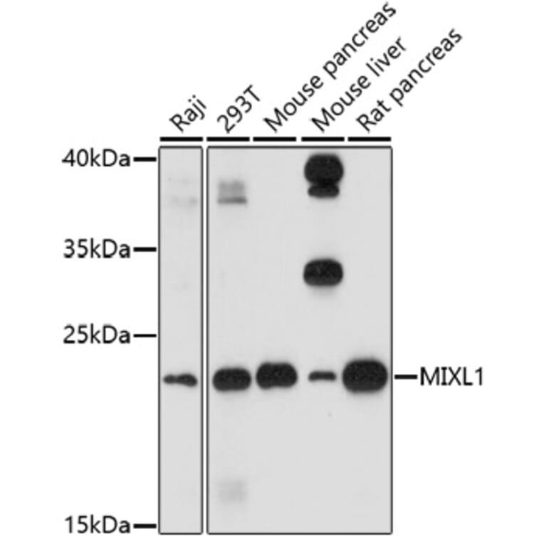 Western Blot - Anti-MIXL1 Antibody (A91714) - Antibodies.com