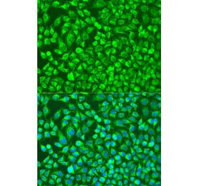 Immunofluorescence - Anti-MMP14 Antibody (A91715) - Antibodies.com