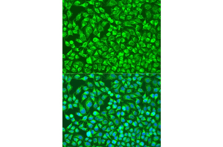 Immunofluorescence - Anti-MMP14 Antibody (A91715) - Antibodies.com