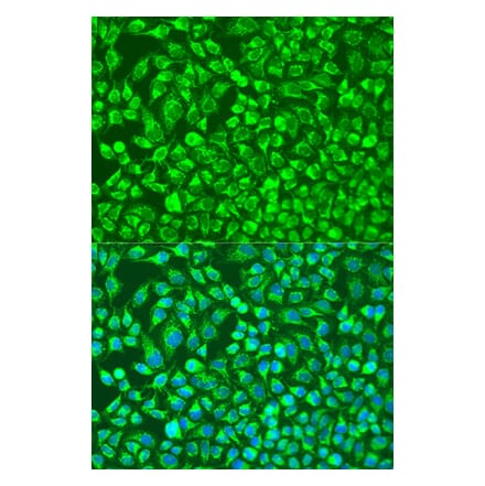 Immunofluorescence - Anti-MMP14 Antibody (A91715) - Antibodies.com