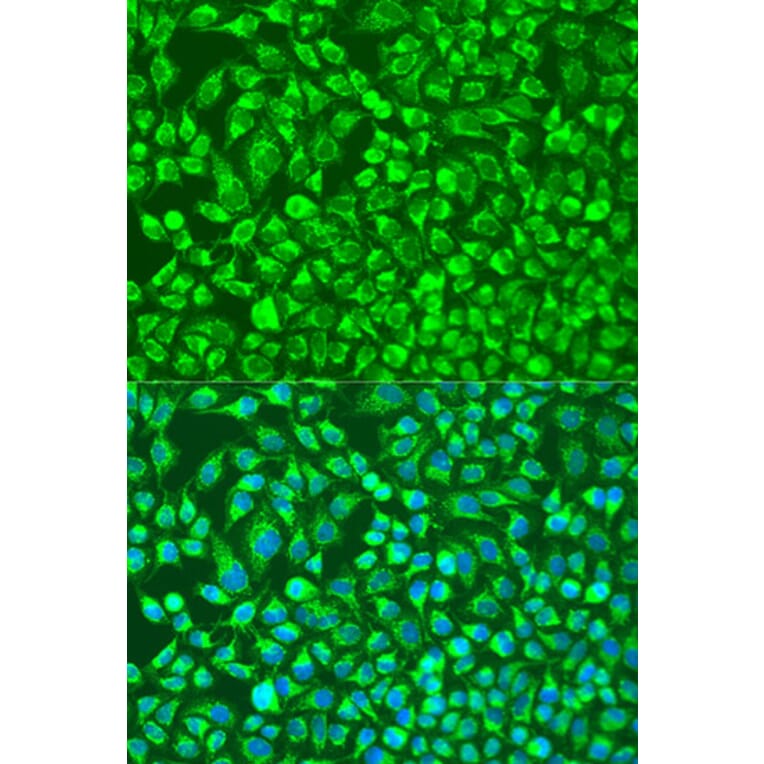 Immunofluorescence - Anti-MMP14 Antibody (A91715) - Antibodies.com