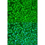 Immunofluorescence - Anti-MMP14 Antibody (A91715) - Antibodies.com